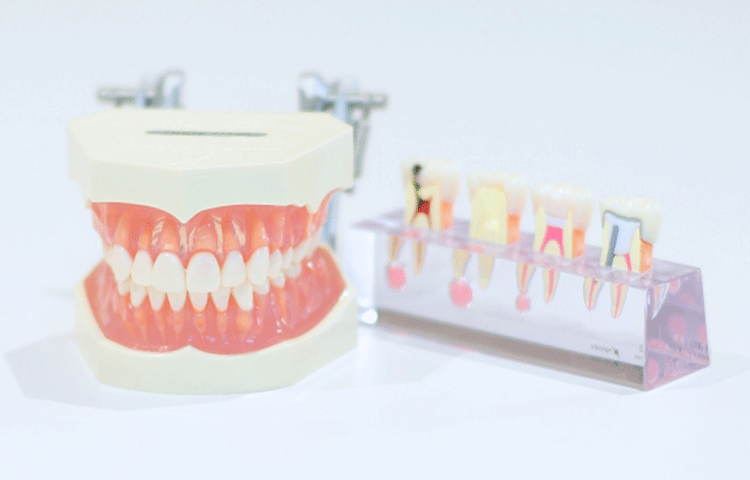 歯の代表的な病気はなんと言っても虫歯です